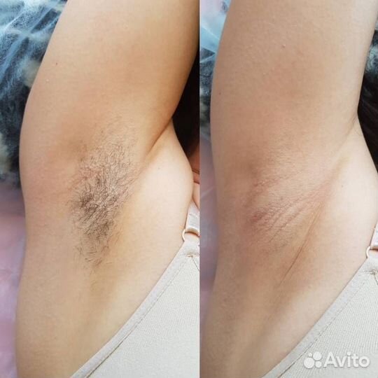 Мастер шугаринга