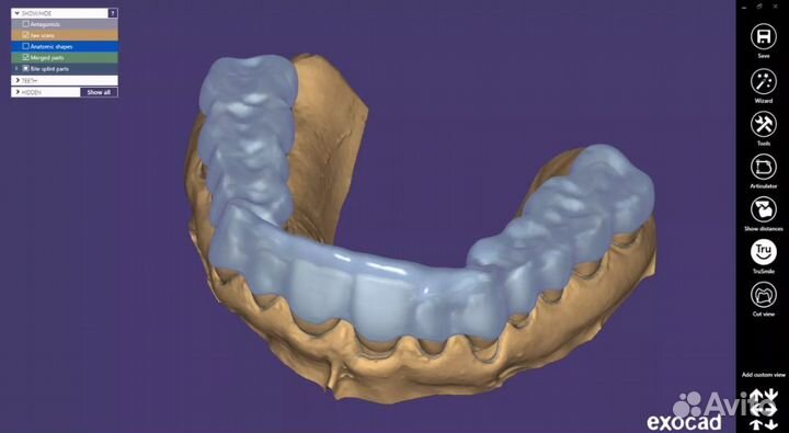 Exocad 8349 (3.1) последняя версия