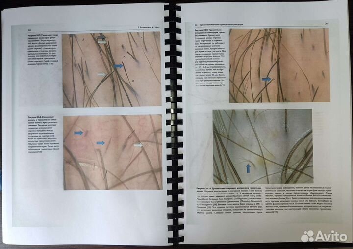 Атлас трихоскопии