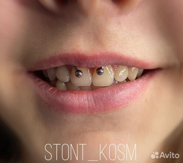 Прокол ушей/пирсинг