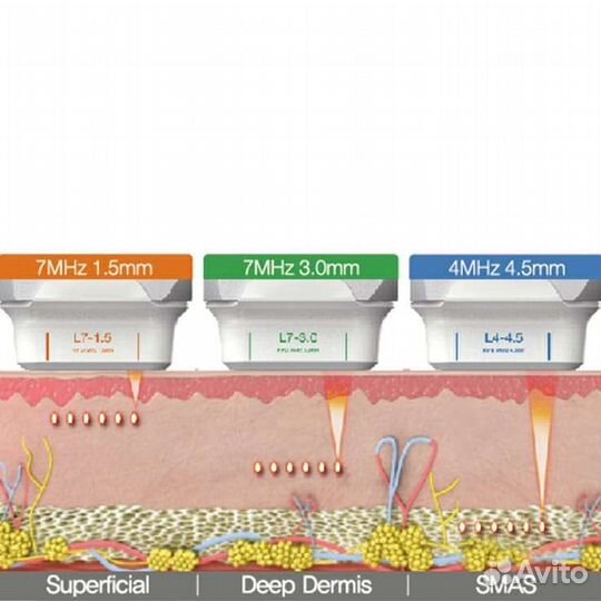Смас похудение ультраформер smas лифтинг