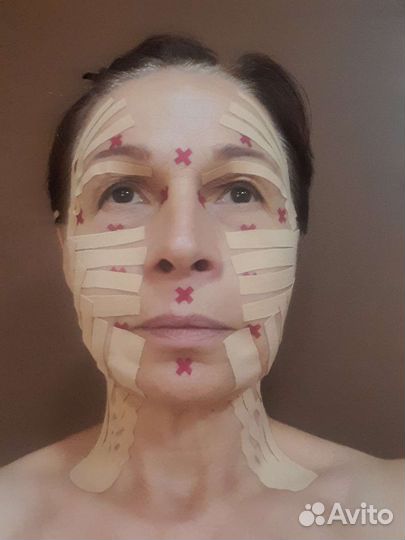 Эстетическое тейпирование