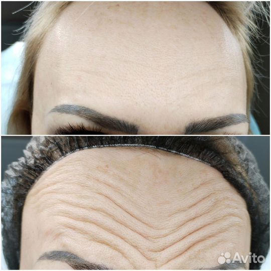 Услуги косметолога