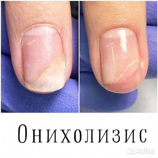 Педикюр