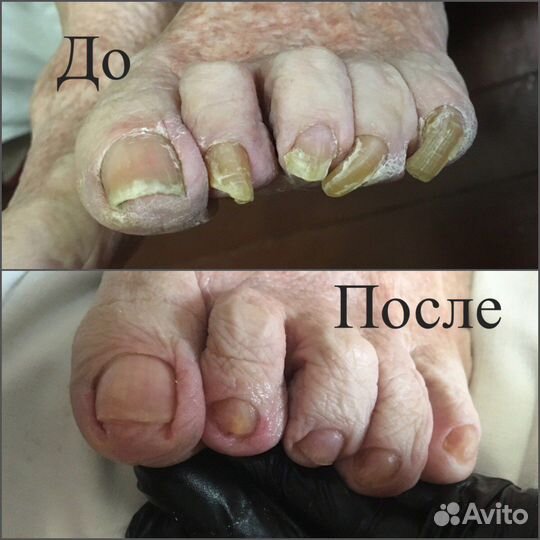 Педикюр маникюр подолог выезд на дом