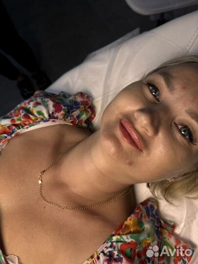 Увелечение губ скул подбородок