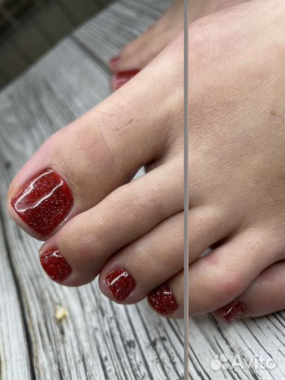 Педикюр на Вые