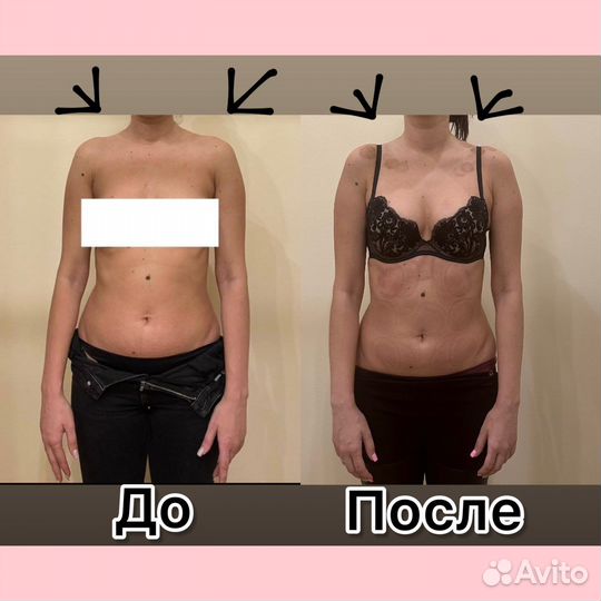 Массаж коррекция фигуры массажем