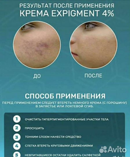 Expigment оригинал/эффективно от пигментации