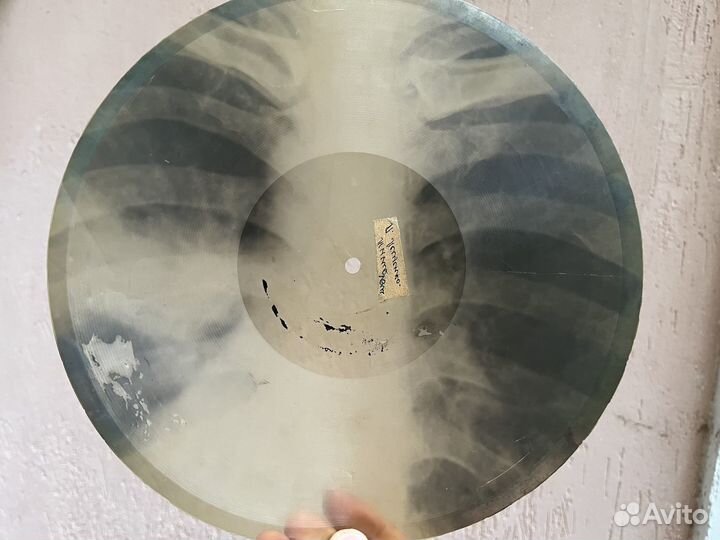 Грамзаписи музыка на рёбрах, костях самиздат