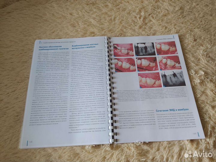 Регенерация пародонта