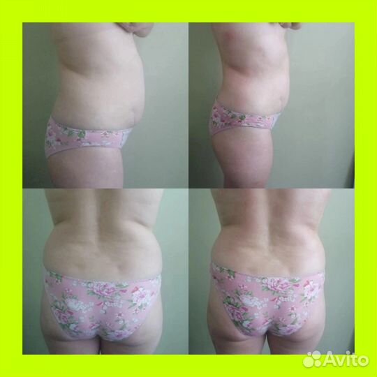 Массаж лица и тела Коррекция фигуры