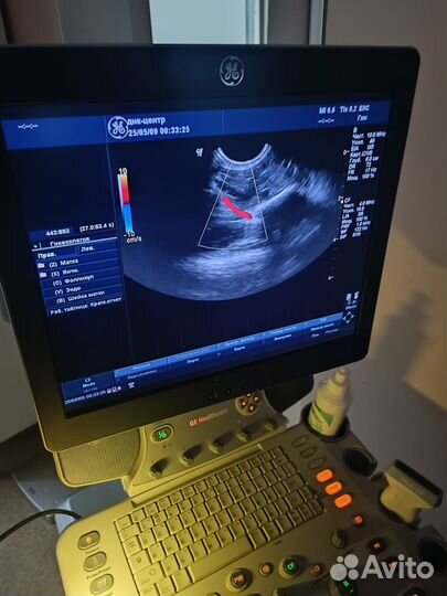 Аренда узи аппарата