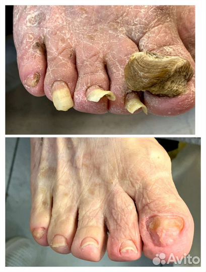 Услуги подолога