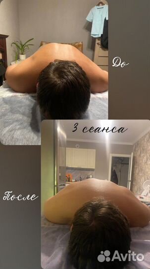 Миофасциальный массаж (сильный)