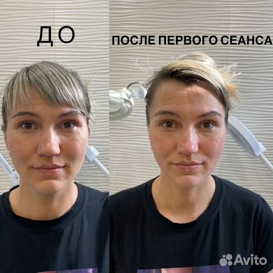 Массаж лица. Скульптурно-букальный,глубокотканный