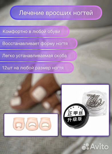 Корректор вросшего ногтя