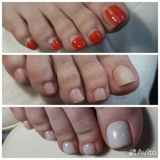 Маникюр педикюр наращивание