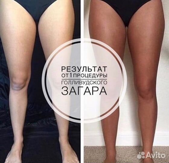 Моментальный загар