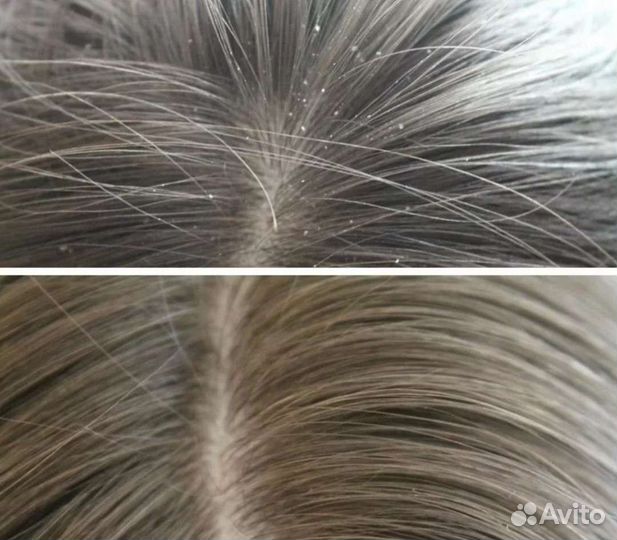 Пилинг для кожи головы