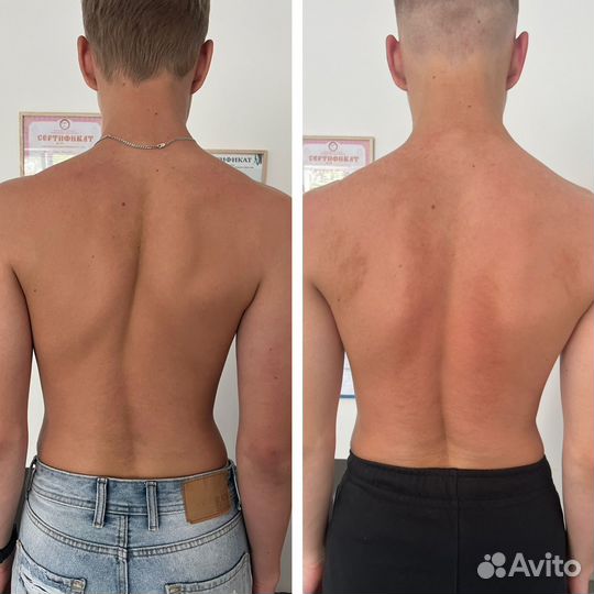 Манульный массаж, костоправ, без боли