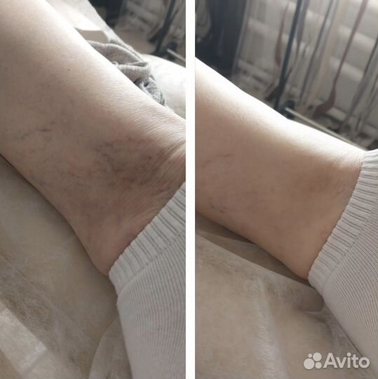 Массаж биоэнергетический