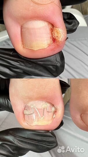 Подолог, проблемы стоп и ногтей, педикюр