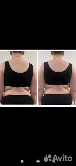 Остеопатия, телесные практики