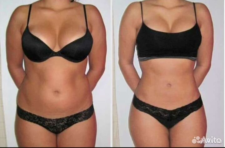 Аппаратное похудение