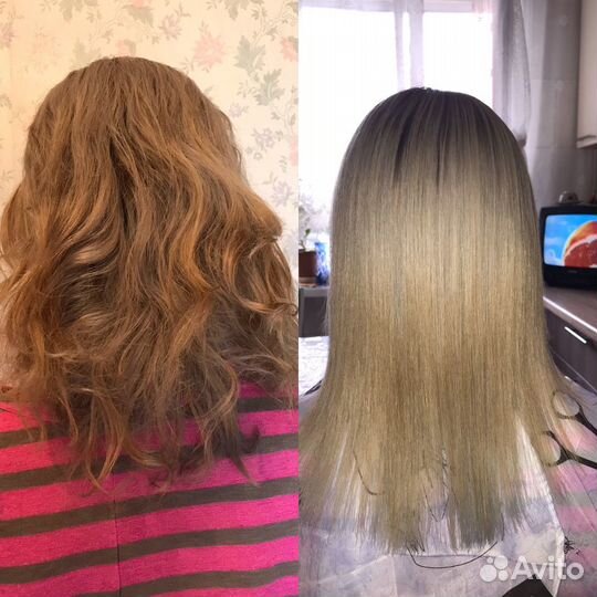 Ботокс;Нанопластика; биксипластия;кератин