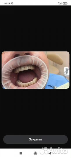 Услуги зубного техника