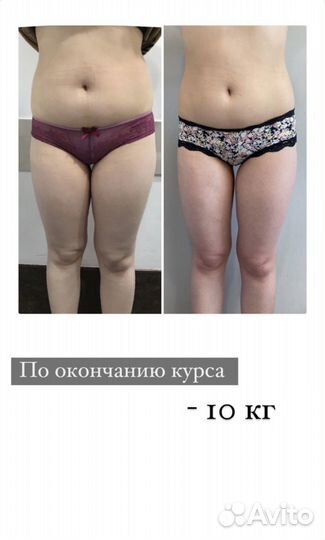 Похудение, Миостимуляция, Kоррекция фигуры