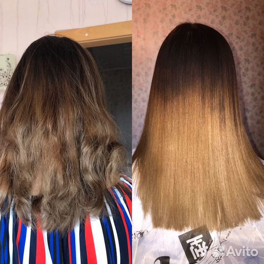 Ботокс;Нанопластика; биксипластия;кератин