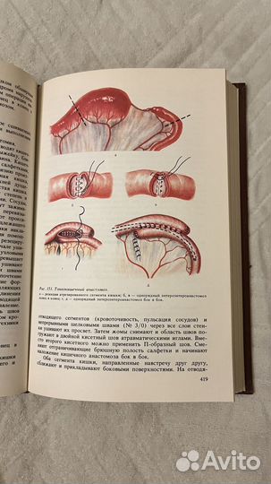 Книга Оперативная хирургия