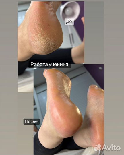 Обучение Педикюру дисками с нуля