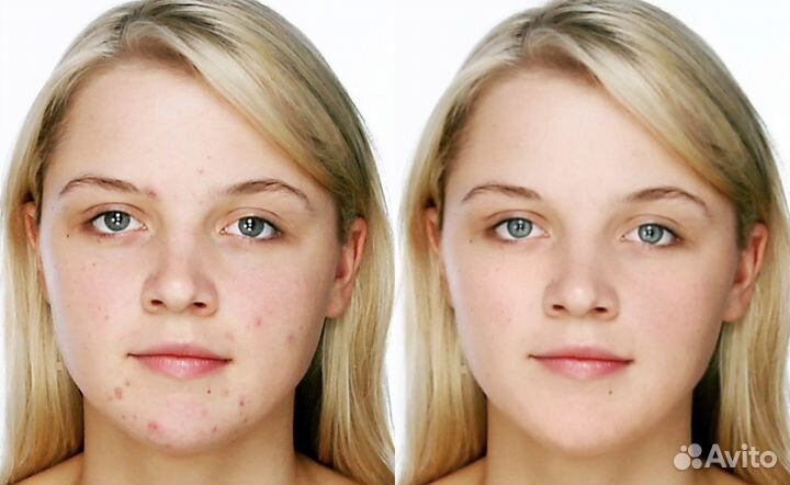 Мобильная обработка фото