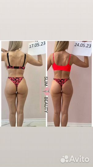 Аппаратная коррекция фигуры, криолиполиз,кавитация