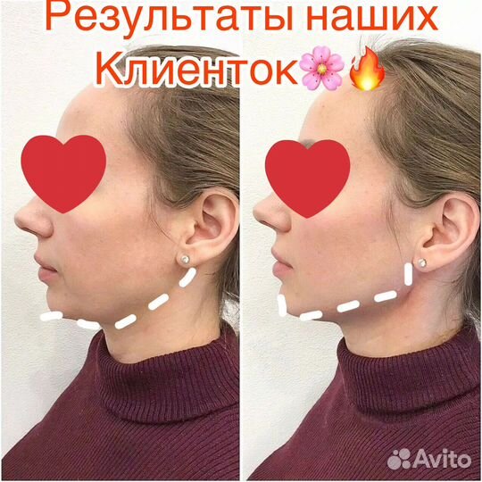 Аппаратное похудение/массаж /кавитация/фитобочка