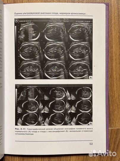Основы ультразвукового скрининга Медведев