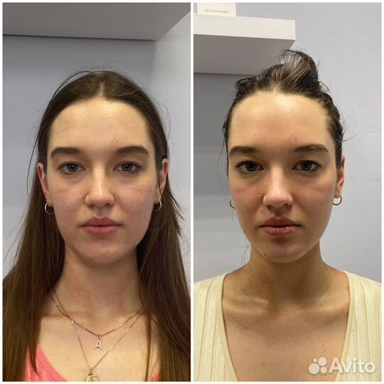 Массаж лица (разные техники)