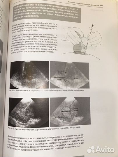 Руководство по ультразвуковой диагностике Пальмера