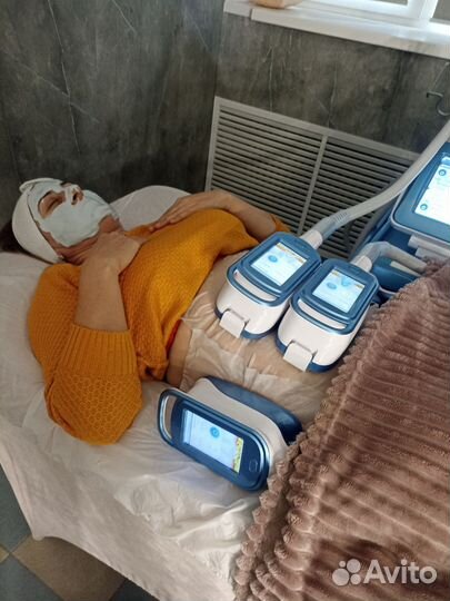 Криолиполиз