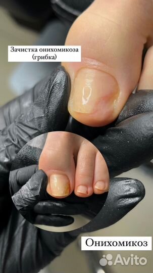 Подология/педикюр