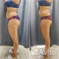 Вакуумный массаж/Миостимуляция/Прессотерапия