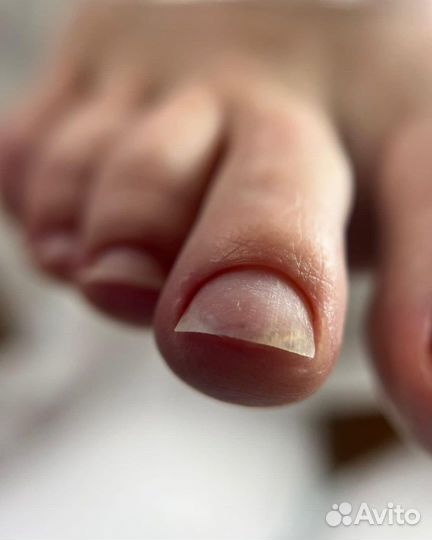 Педикюр с покрытием лаком