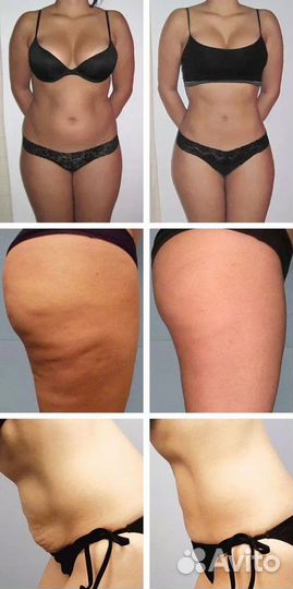 Убери лишний жир на новейшем криорф слим