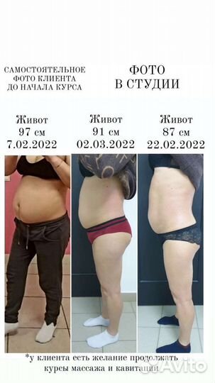 Вакуумный массаж, кавитация, RF-лифтинг