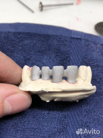 Зуботехническое Литье и Пресс E-Max