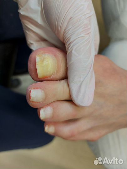 Маникюр/педикюр/медицинский педикюр