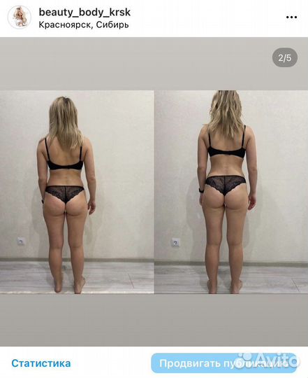 Антицеллюлитный массаж